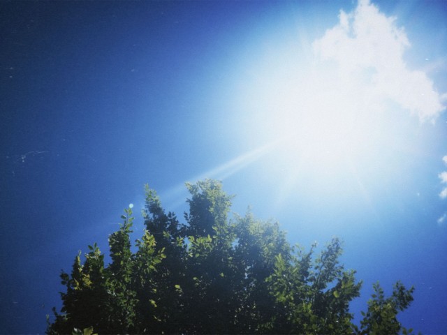 The sun was very bright today, and I got my skin tanned.
